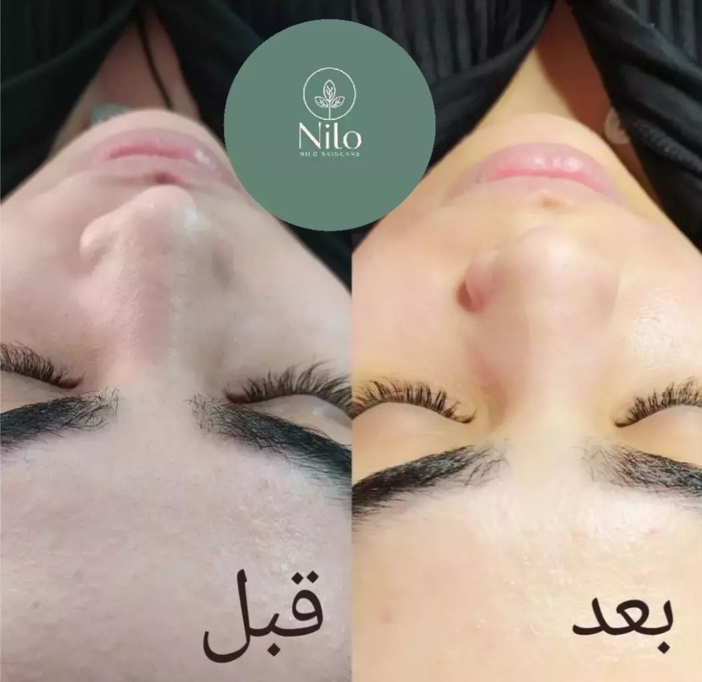 پاکسازی پوست